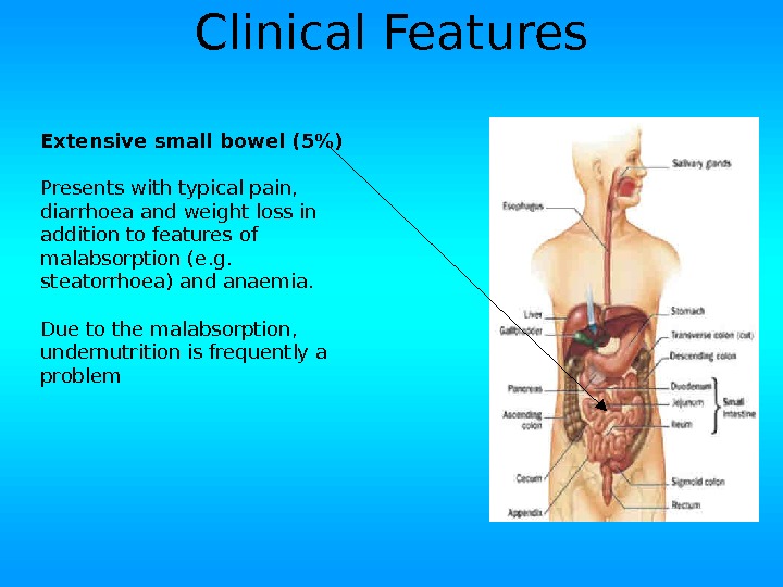 Extensive small bowel (5) Presents with typical pain,  diarrhoea and weight loss in addition to