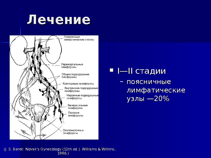  I—II стадии – поясничные лимфатические узлы — 20 Лечение (J. S. Berek. Novak’s Gynecology (12
