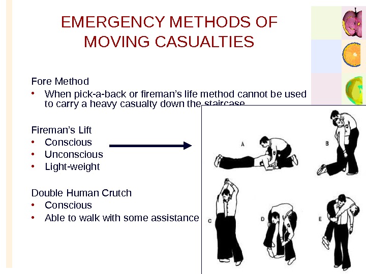   EMERGENCY METHODS OF MOVING CASUALTIES Fore Method • When pick-a-back or fireman’s life method