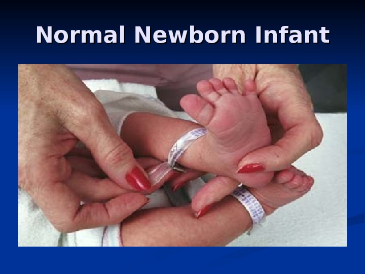 Normal Newborn Infant 