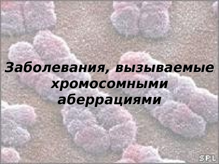   Заболевания, вызываемые хромосомными аберрациями 