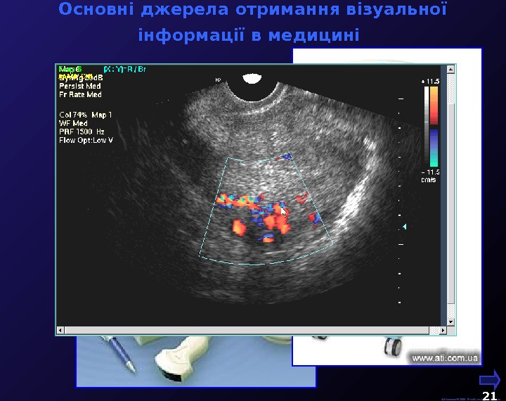  Основні джерела отримання візуальної інформації в медицині  М. Кононов © 2009 E-mail: mvk@univ. kiev.