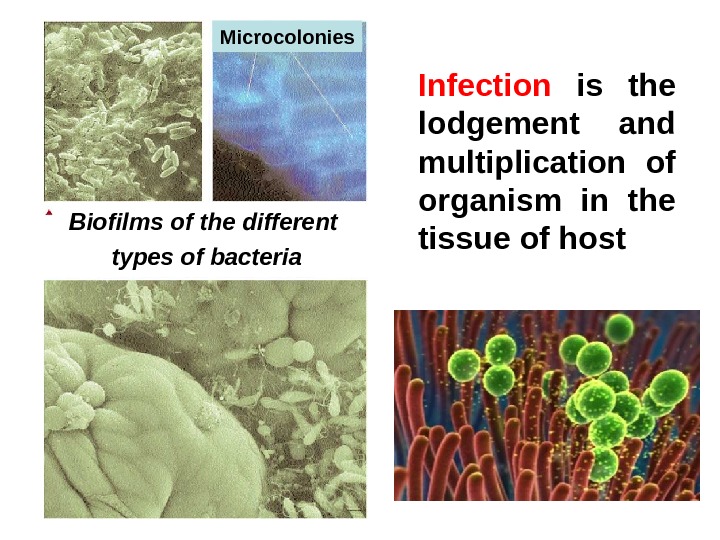   Infection  is the lodgement  and multiplication of organism in the tissue of