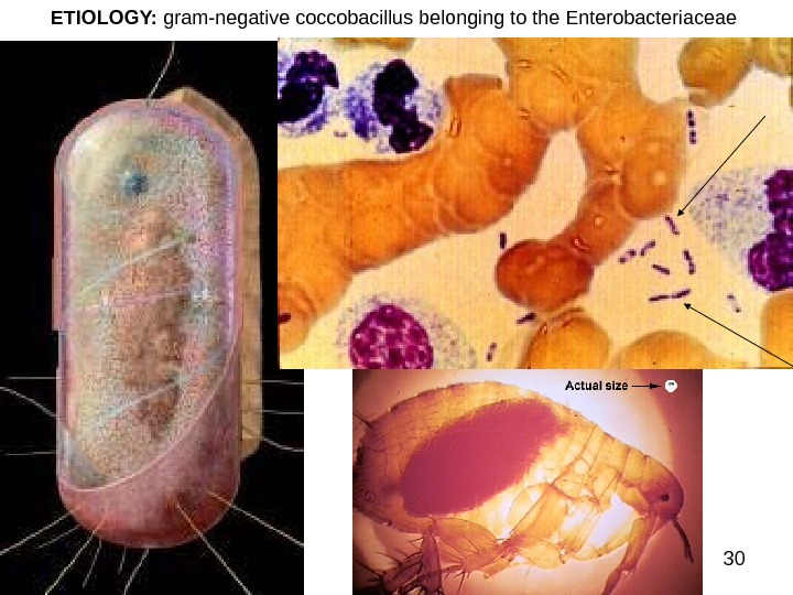30 ETIOLOGY:  gram-negative coccobacillus belonging to the Enterobacteriaceae 