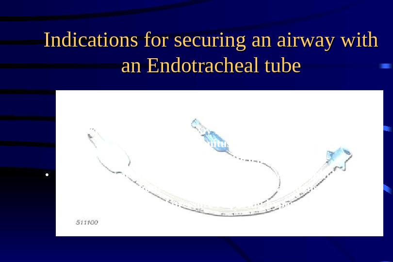 Indications for securing an airway with an Endotracheal tube • Apnea • Obstruction of upper airway