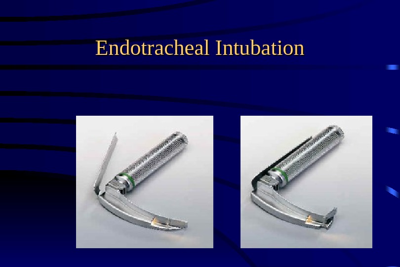 Endotracheal Intubation 