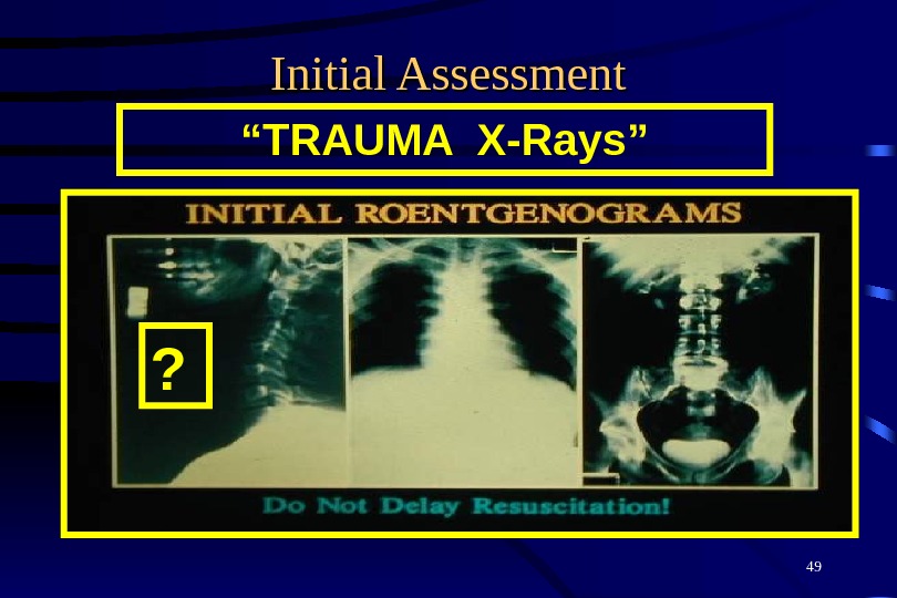 49 Initial Assessment “ TRAUMA X-Rays” ? 