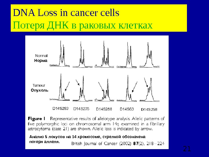  21 DNA Loss in cancer cells Потеря ДНК в раковых клетках Норма Опухоль Анализ 5