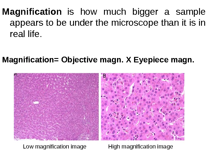 Magnification  is how much bigger a sample appears to be under the microscope than it