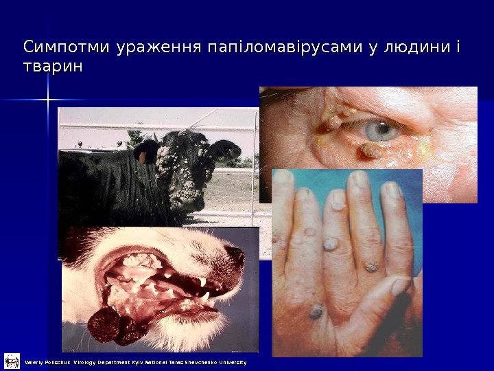 Симпотми ураження папіломавірусами у людини і тварин Valeriy Polischuk Virology Department Kyiv National Taras Shevchenko University