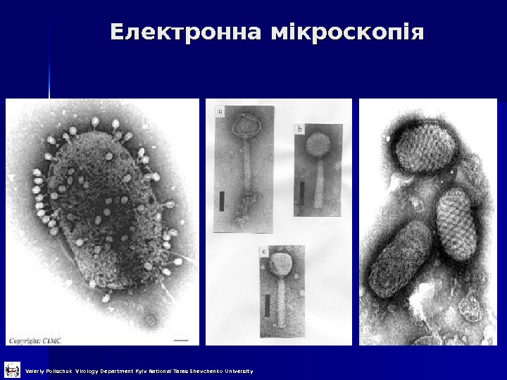 Електронна мікроскопія  Valeriy Polischuk Virology Department Kyiv National Taras Shevchenko University 