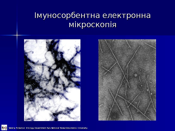   Імуносорбентна електронна мікроскопія Valeriy Polischuk Virology Department Kyiv National Taras Shevchenko University 