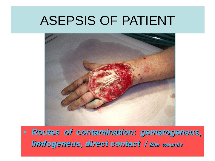  31 ASEPSIS OF PATIENT • Routes of contamination:  gematogeneus,  limfogeneus, direct contact /