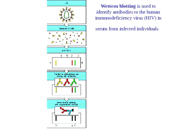   Western blotting is used to identify antibodies to the human immunodeficiency virus (HIV) in