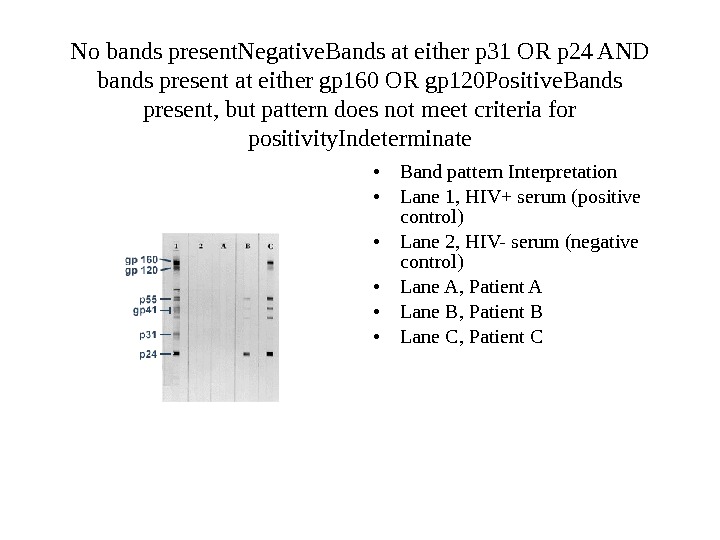   No bands present. Negative Bands at either p 31 OR p 24 AND bands