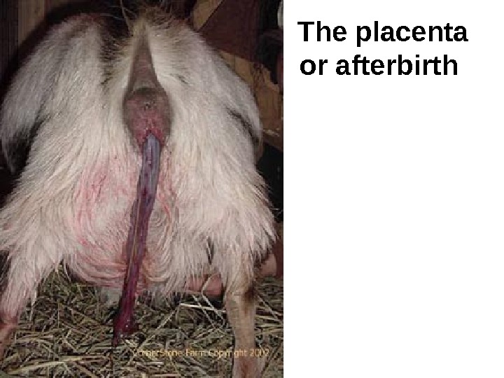 The placenta or afterbirth  