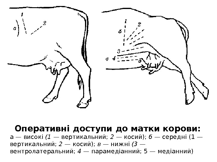 Оперативні доступи до матки корови: а — високі (1 — вертикальний;  2 — косий); 