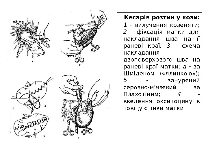 Кесарів розтин у кози: 1 - вилучення козеняти;  2 - фіксація матки для накладання шва