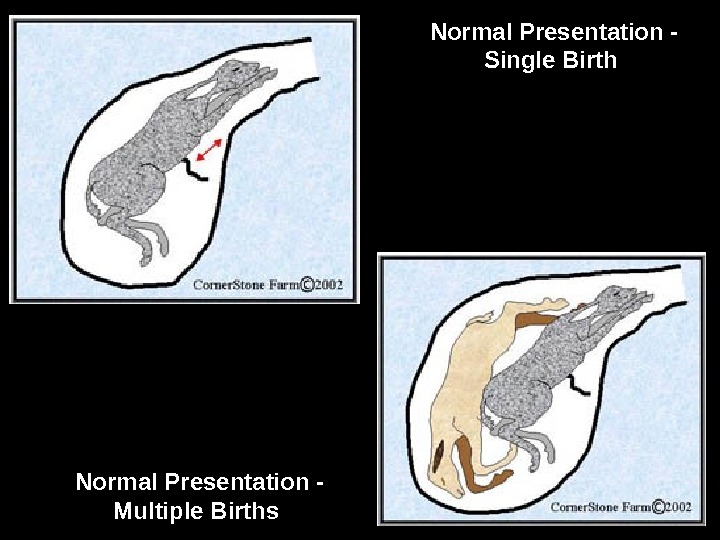 Normal Presentation - Single Birth  Normal Presentation - Multiple Births  