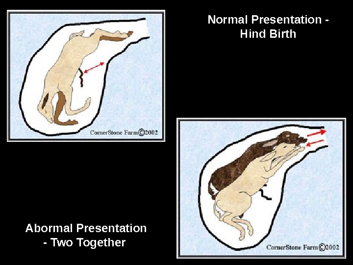 Normal Presentation - Hind Birth Abormal Presentation - Two Together  
