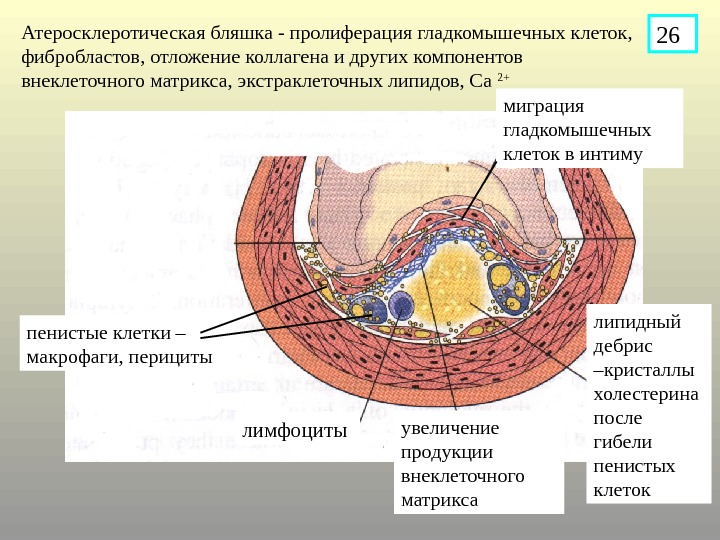   Атеросклеротическая бляшка - пролиферация гладкомышечных клеток,  фибробластов, отложение коллагена и других компонентов внеклеточного