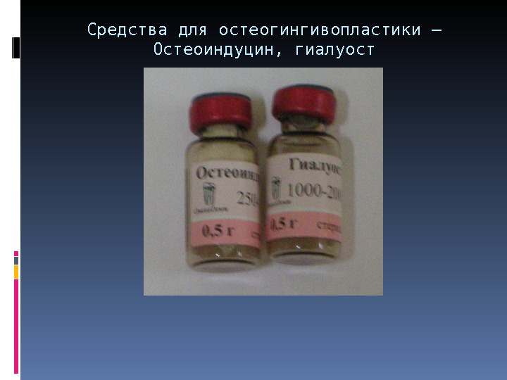 Средства для остеогингивопластики – Остеоиндуцин, гиалуост 