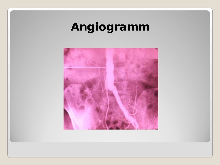 Angiogramm 