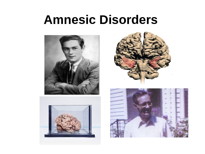   Amnesic Disorders  