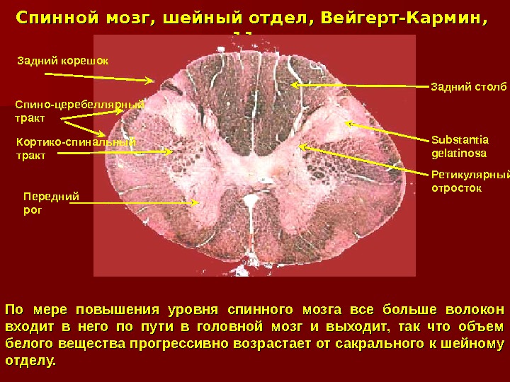 Спинной мозг, шейный отдел, Вейгерт-Кармин, 11 x. По мере повышения уровня спинного мозга все больше волокон