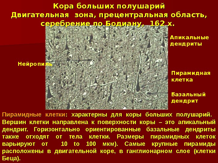 Кора больших полушарий Двигательная зона, прецентральная область,  серебрение по Бодиану,  162 x.  Пирамидные