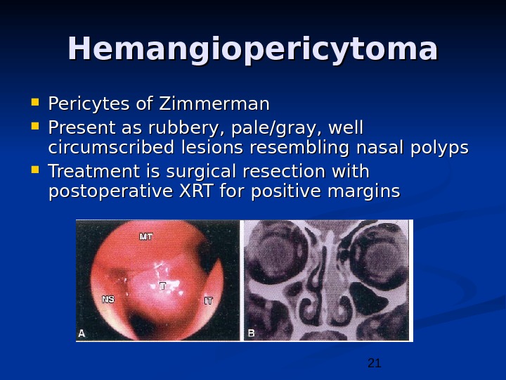 21 Hemangiopericytoma Pericytes of Zimmerman Present as rubbery, pale/gray, well circumscribed lesions resembling nasal polyps Treatment