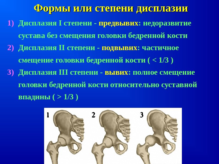 1) Дисплазия I степени - предвывих : недоразвитие сустава без смещения головки бедренной кости2) Дисплазия II степени - подвывих : частичное смещение головки бедренной кости