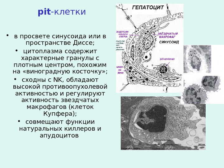 pit -клетки  • в просвете синусоида или в пространстве Диссе;  • цитоплазма содержит характерные