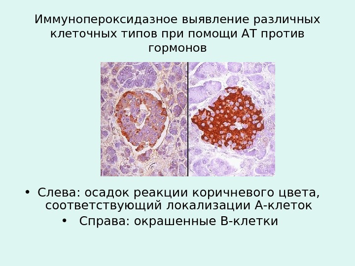 Иммунопероксидазное выявление различных клеточных типов при помощи АТ против гормонов • Слева: осадок реакции коричневого цвета,