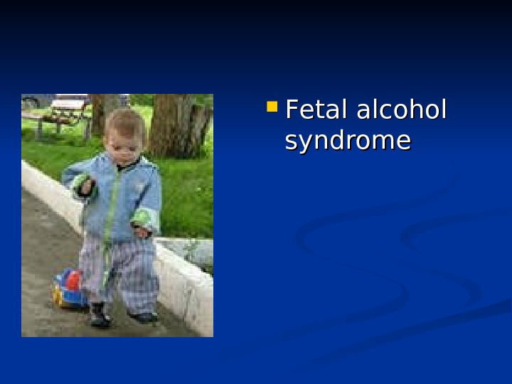  FF etal alcohol syndrome 