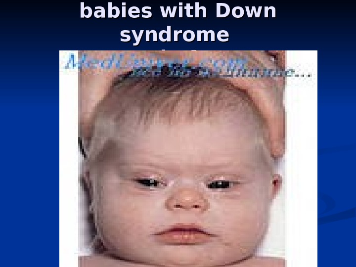 babies with Down syndrome people funny 