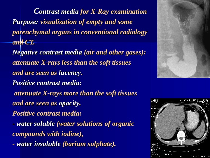   CC ontrast media for X-Ray examination Purpose:  visualization of empty and some parenchymal
