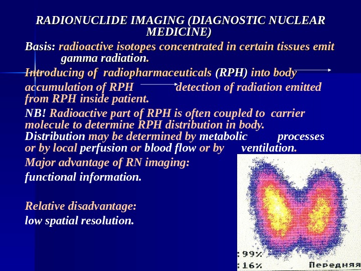 RADIONUCLIDE IMAGING (DIAGNOSTIC NUCLEAR MEDICINE)  Basis:  radioactive isotopes concentrated in certain tissues emit gamma
