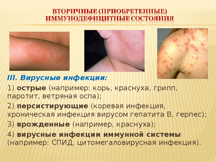 III. Вирусные инфекции:  1) острые (например: корь, краснуха, грипп,  паротит, ветряная оспа);  2)