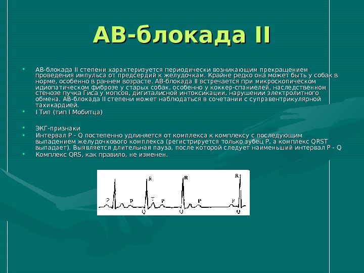 АВ-блокада II • АВ-блокада II степени характеризуется периодически возникающим прекращением проведения импульса от предсердий к желудочкам.