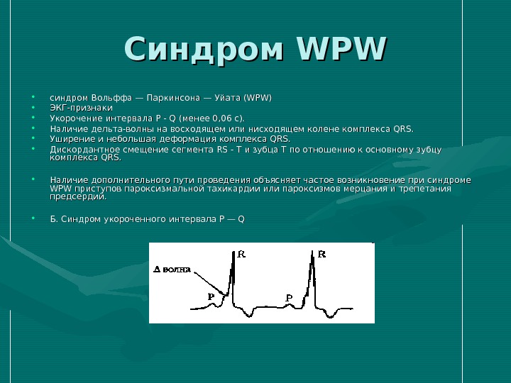 Синдром WPW • синдром Вольффа — Паркинсона — Уйата (WPW) • ЭКГ-признаки • Укорочение интервала Р