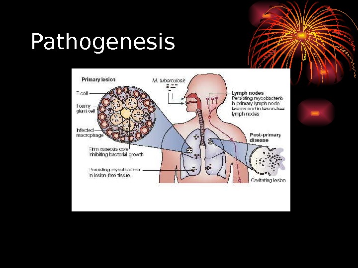   Pathogenesis 