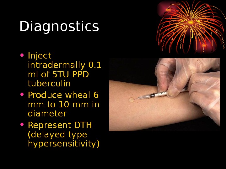   Diagnostics • Inject intradermally 0. 1 ml  of 5 TU PPD tuberculin •