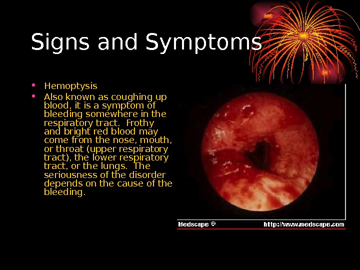   Signs and Symptoms • Hemoptysis • Also known as coughing up blood, it is