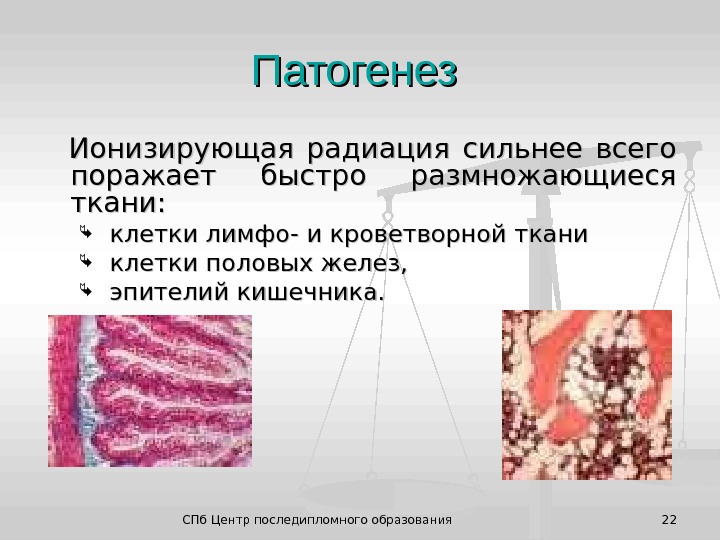 СПб Центр последипломного образования 22Патогенез   Ионизирующая радиация сильнее всего поражает быстро размножающиеся ткани: клетки