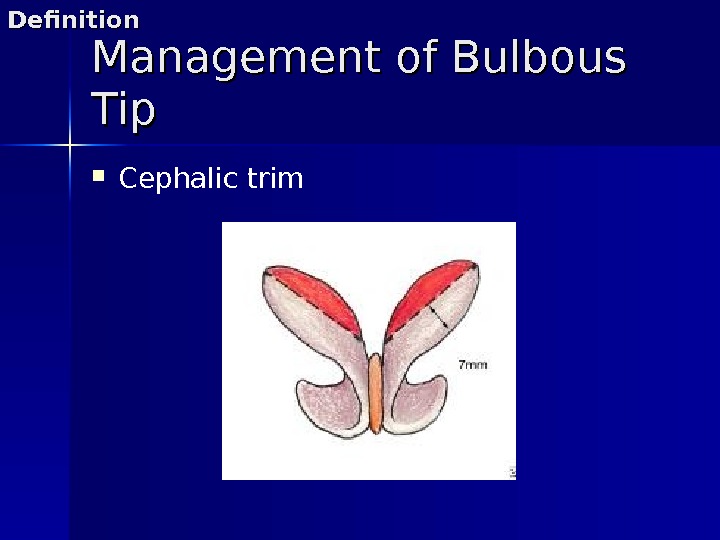 Management of Bulbous Tip Cephalic trim. Definition 