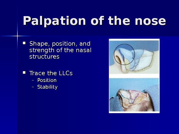 Palpation of the nose Shape, position, and strength of the nasal structures Trace the LLCs –