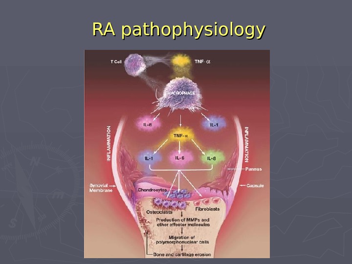   RA pathophysiology 