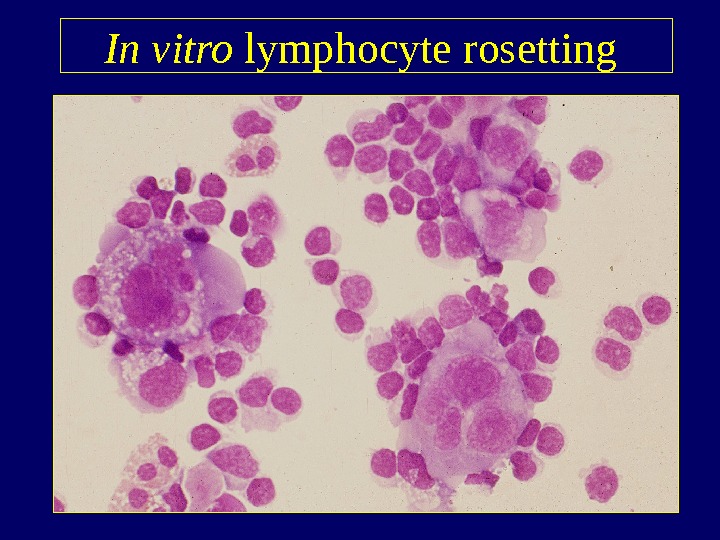   In vitro lymphocyte rosetting  