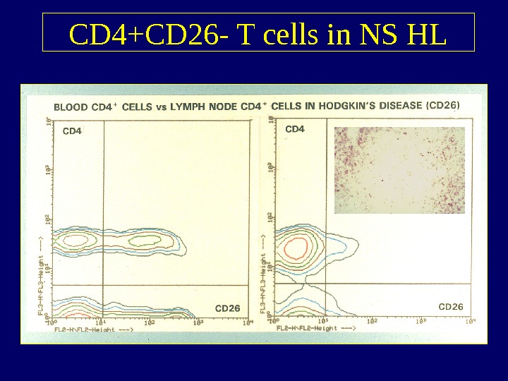   CD 4+CD 26 - T cells in NS HL 